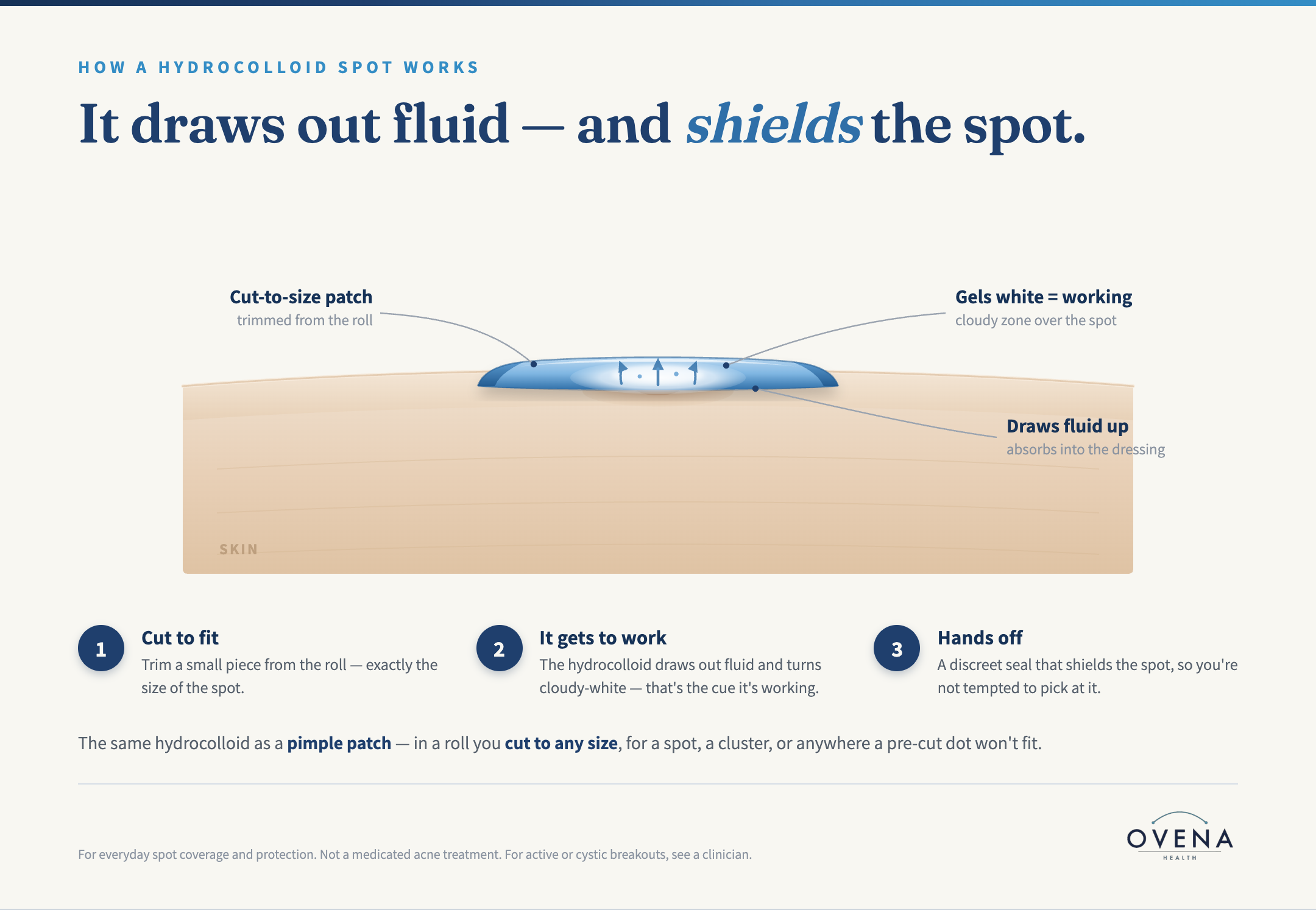 Diagram: how a hydrocolloid patch works — cut to size, draws fluid and turns white, shields the spot in a water-resistant moist seal.