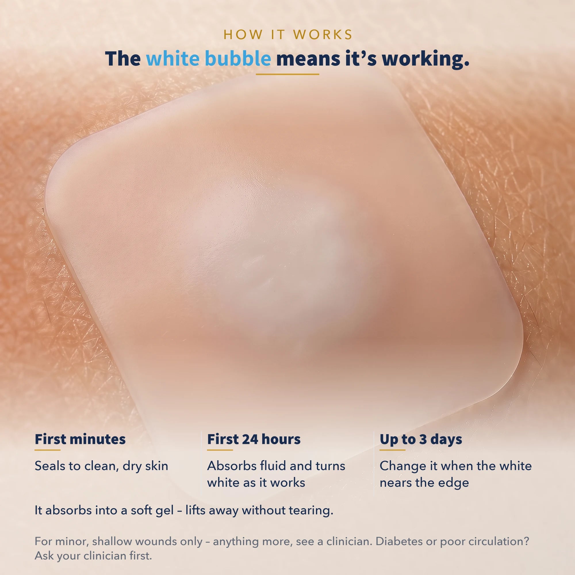 Hydrocolloid Roll, Cut-to-Size